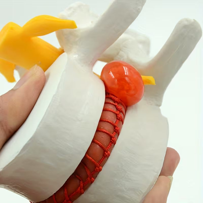 1pc Modelo De Hernia De Disco Intervertebral De Demostración Simulador Vertebral Columna