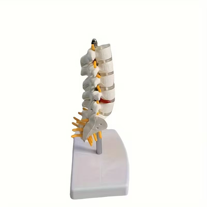 Modelo de Columna Lumbar Humana con Disco Herniado