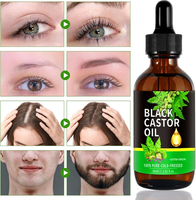 1 unidad de Aceite de Ricino 60 ml/2.02 fl oz, Aceite Esencial Prensado en Frío para Cuidado del Cabello - Quierox - Tienda Online
