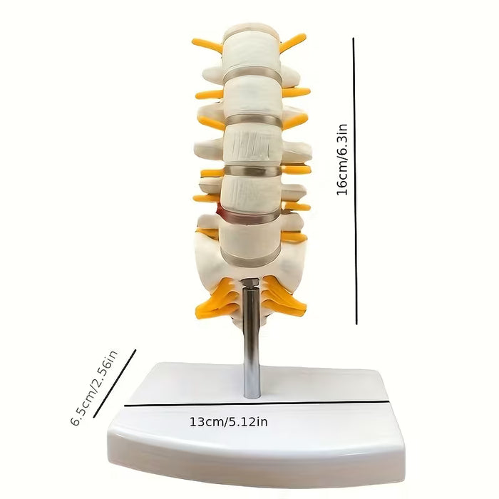 Modelo de Columna Lumbar Humana con Disco Herniado