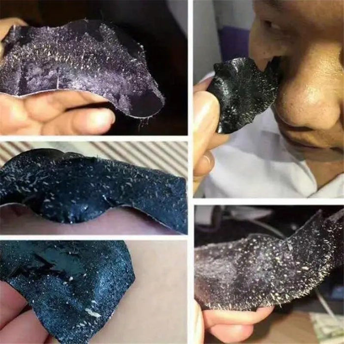 13 Tiras de limpieza profunda de poros de nariz de puntos negros - Quierox - Tienda Online