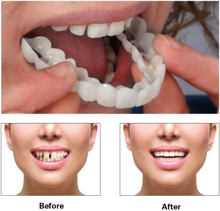 2 pares naturales y cómodos para recuperar una sonrisa segura - Quierox - Tienda Online