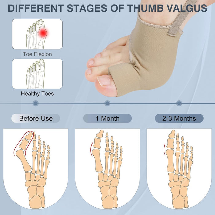 2 piezas correctores de juanetes para mujeres y hombres, calcetines para juanetes - Quierox - Tienda Online