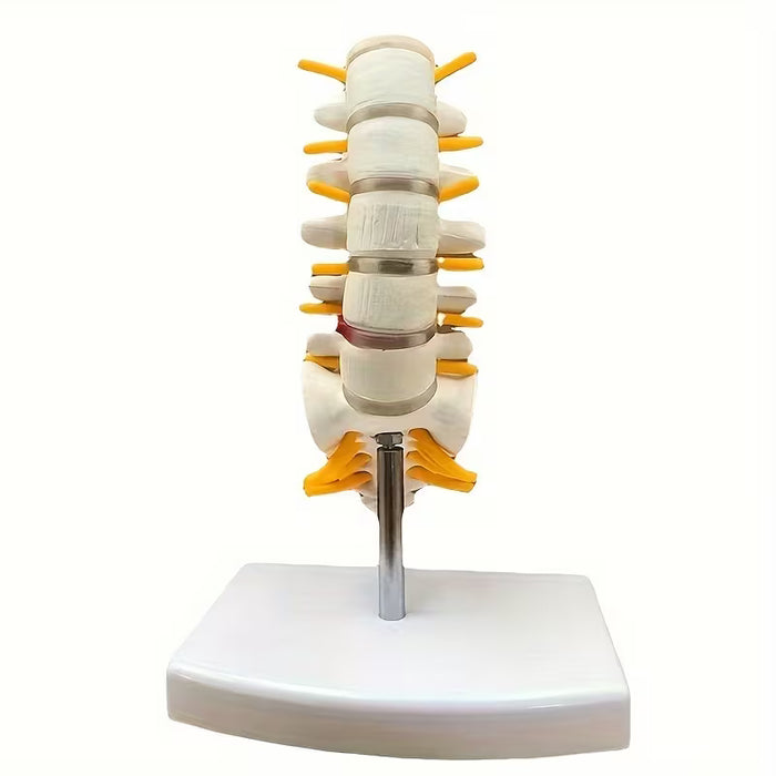 Modelo de Columna Lumbar Humana con Disco Herniado