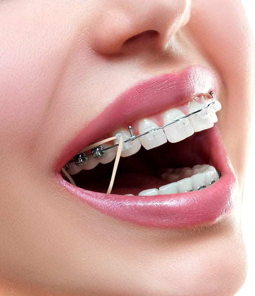 500 bandas elásticas de ortodoncia, de tracción de goma dental de 4.5 onzas de tamaño 1/4 pulgadas - Quierox - Tienda Online