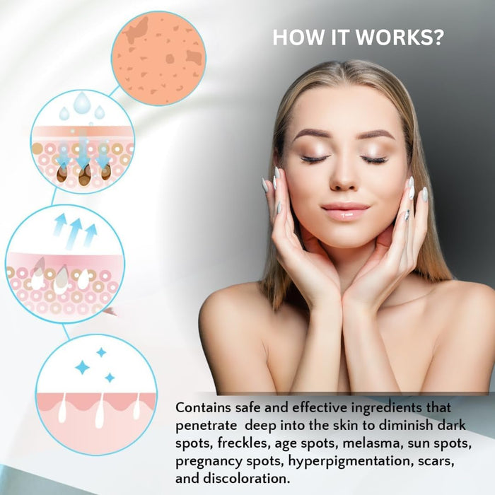 Anyi Beauty Eliminador de manchas oscuras para rostro y cuerpo, crema blanqueadora facial
