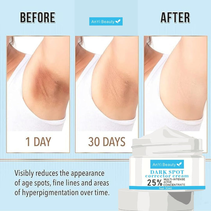 Anyi Beauty Eliminador de manchas oscuras para rostro y cuerpo, crema blanqueadora facial
