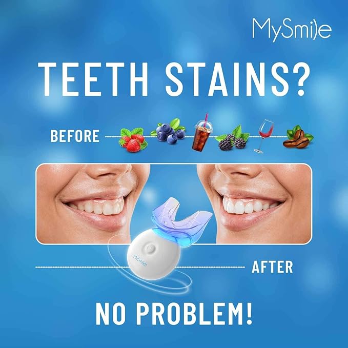 Kit de blanqueamiento de dientes MySmile con luz LED