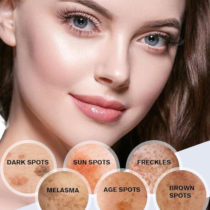 Anyi Beauty Eliminador de manchas oscuras para rostro y cuerpo, crema blanqueadora facial