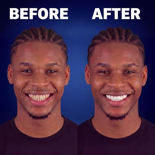 Tiras blanqueadoras dentales para hombres – Kit profesional de blanqueamiento en casa, 14 tratamientos (28 tiras)