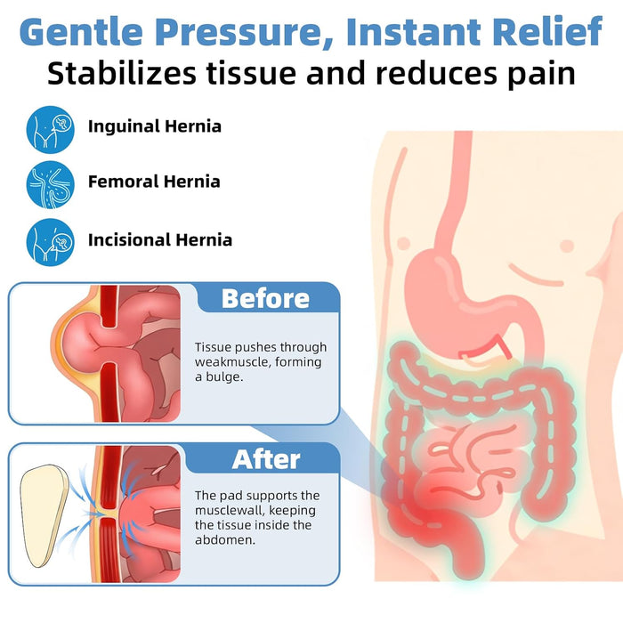 Cinturones para hernia inguinal para hombres y mujeres
