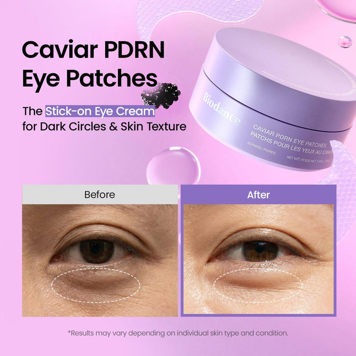 BIODANCE Parches de hidrogel para ojos debajo de los ojos, caviar PDRN, deshinchamiento y bolsas para los ojos (30 pares)