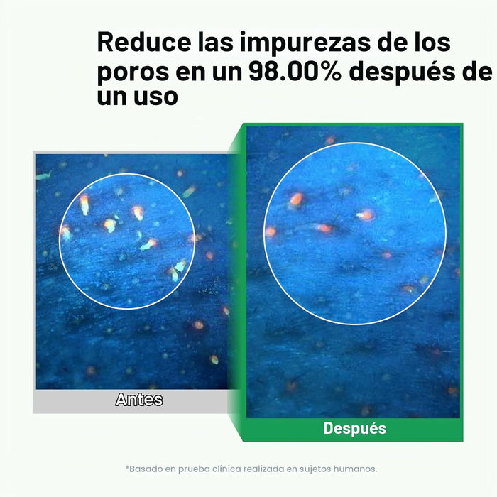 PONGDANG Aceite limpiador de limpieza profunda de poros (6.76 onzas líquidas)
