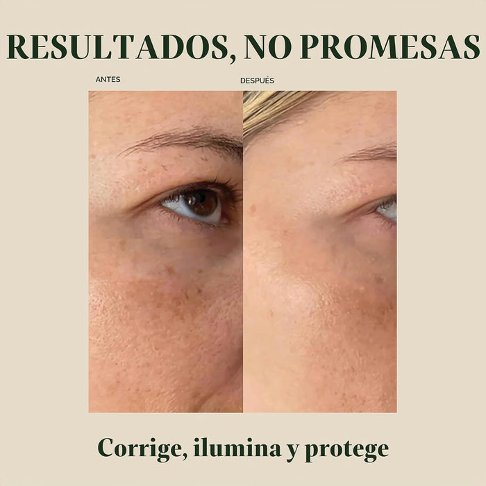 Kat Burki Crema facial intensiva con vitamina C