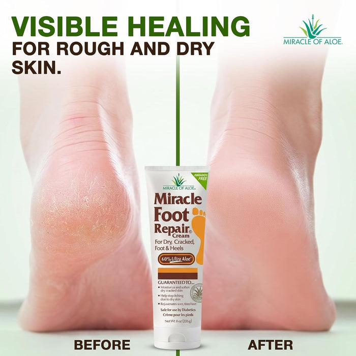 Miracle Foot Repair Cream, 8 onzas repara talones y pies agrietados secos
