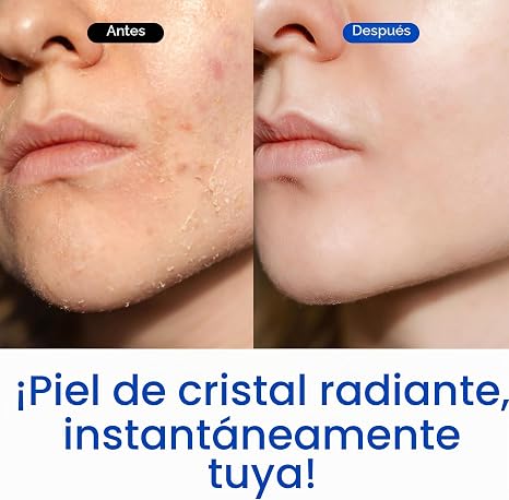 IVOSKIN Máscara facial de burbujas lechosas de arroz, tónico facial