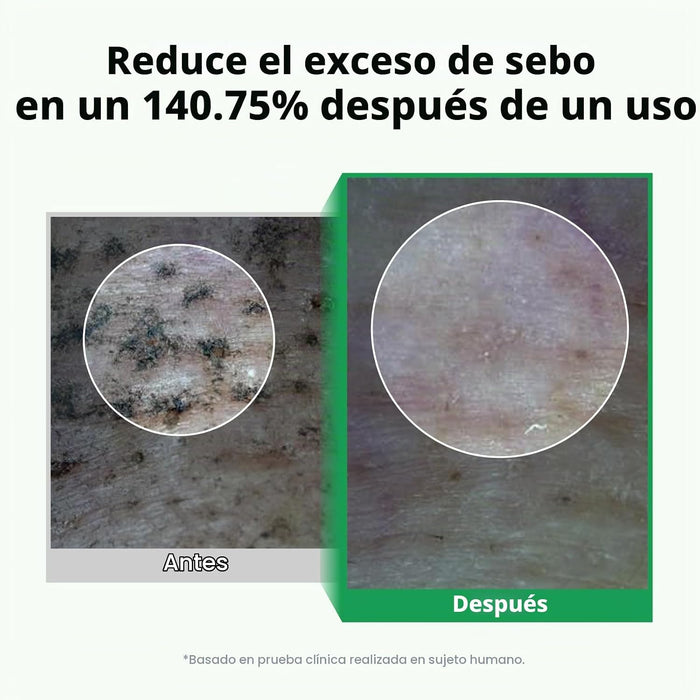 PONGDANG Aceite limpiador de limpieza profunda de poros (6.76 onzas líquidas)