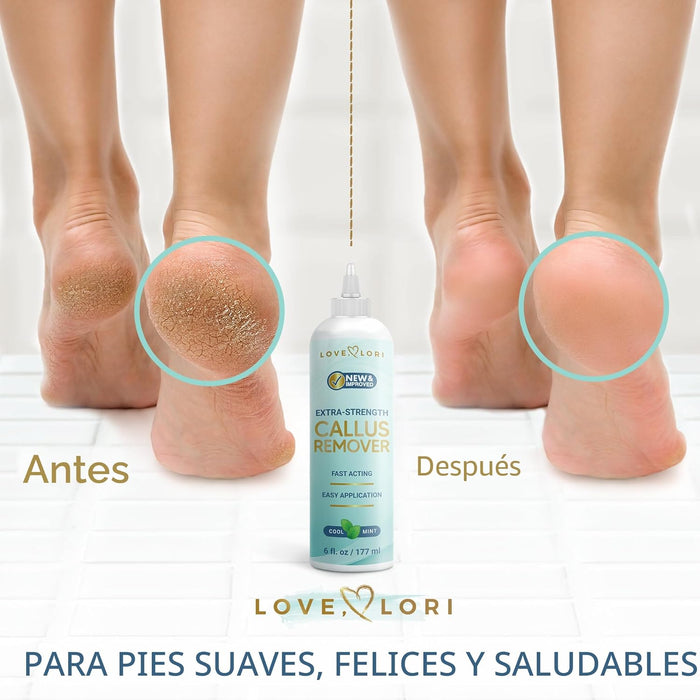 Removedor de callos para pies, esenciales de spa para el cuidado de los pies