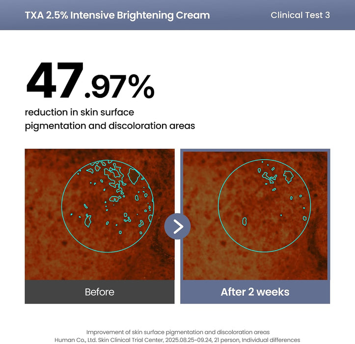 Crema iluminadora AXIS-Y TXA 2.5% - Ácido tranexámico, para corrección de manchas oscuras
