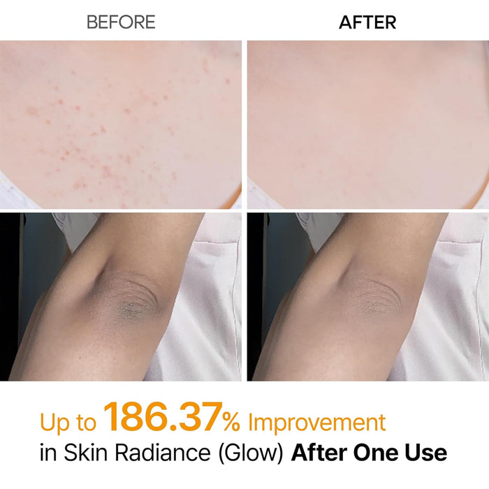 Dr.Melaxin Peel Shot Exfoliante corporal de cúrcuma de ácido kójico, 6.76 onzas líquidas