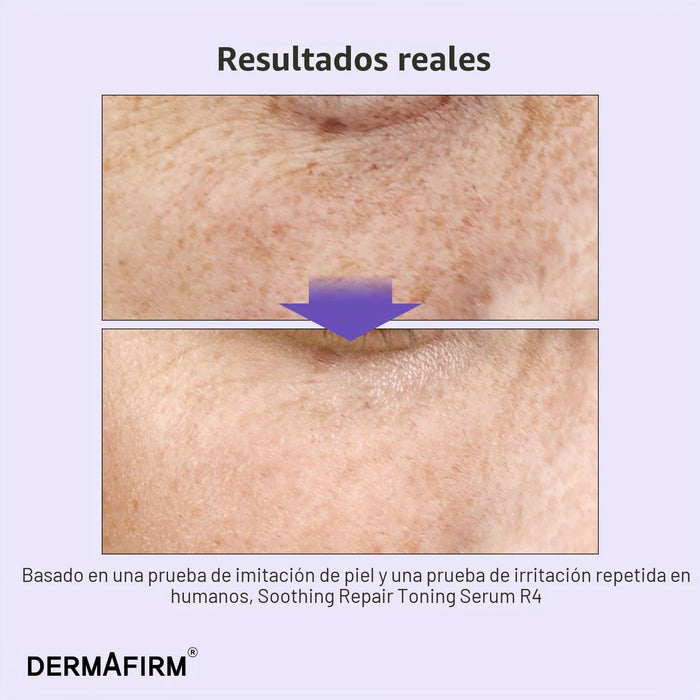 DERMAFIRM Bakuchiol - Suero de retinol para piel de vidrio con niacinamida y péptidos