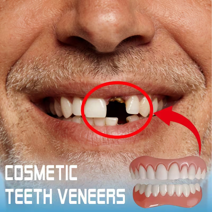 Set de 2 Cubiertas de Dientes Cosméticas con Clip y Facetas