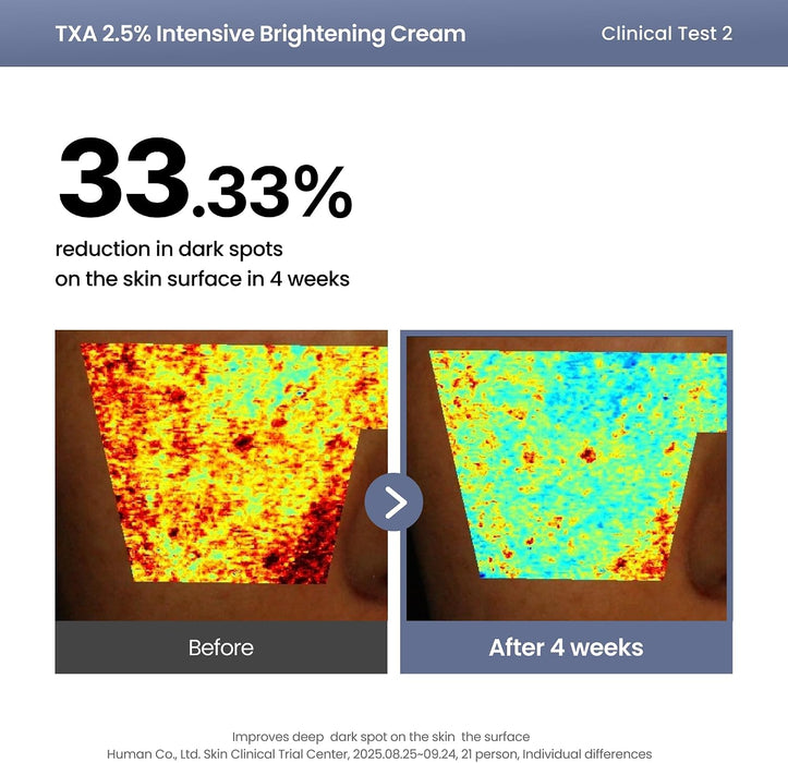 Crema iluminadora AXIS-Y TXA 2.5% - Ácido tranexámico, para corrección de manchas oscuras