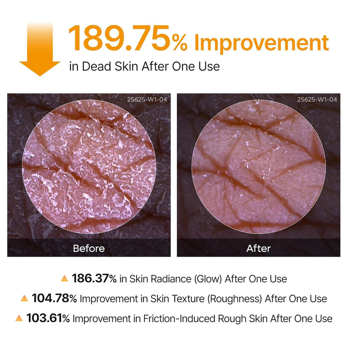 Dr.Melaxin Peel Shot Exfoliante corporal de cúrcuma de ácido kójico, 6.76 onzas líquidas