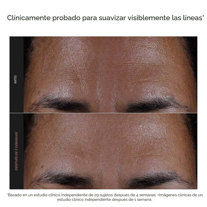 Paula's Choice Exfoliante líquido con 2 % de BHA para perfeccionar la piel