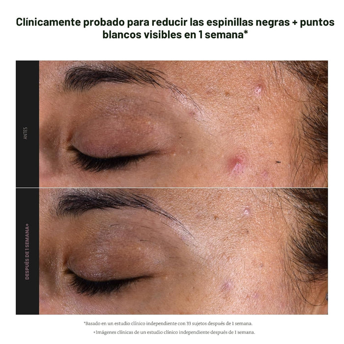 Paula's Choice Exfoliante líquido con 2 % de BHA para perfeccionar la piel