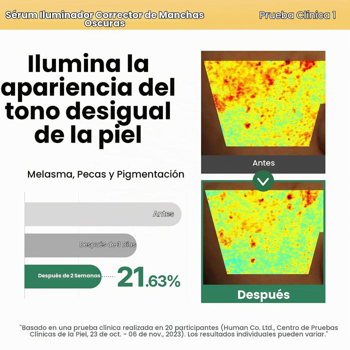 AXIS-Y Suero corrector de manchas oscuras – 5% niacinamida removedor de manchas oscuras para la cara