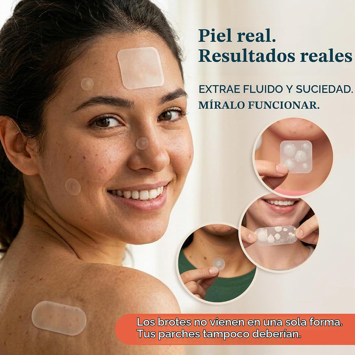 Livaclean Paquete variado de 272 unidades de parches grandes para espinillas en la cara