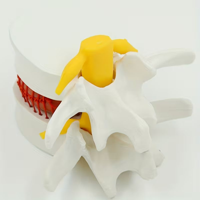 1pc Modelo De Hernia De Disco Intervertebral De Demostración Simulador Vertebral Columna