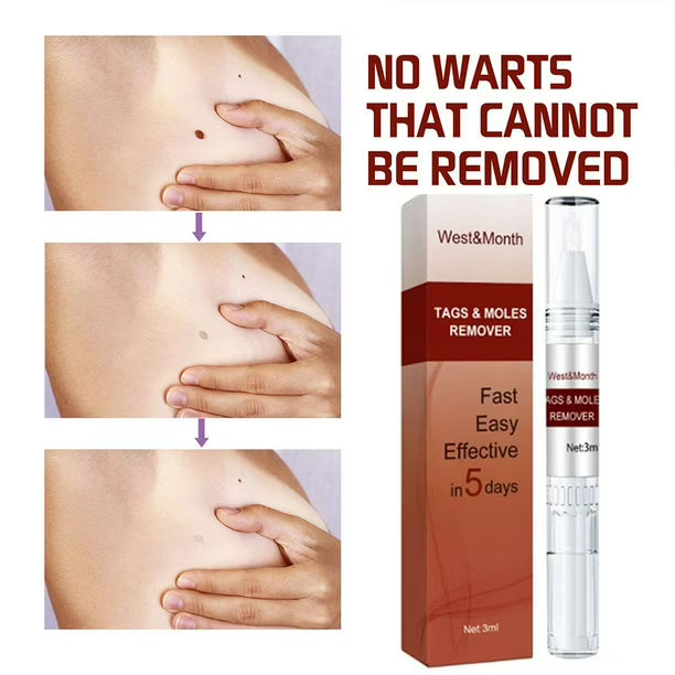 Lápiz líquido para eliminar verrugas genitales Wipeoff Tags & Moles Remover, 3 ml