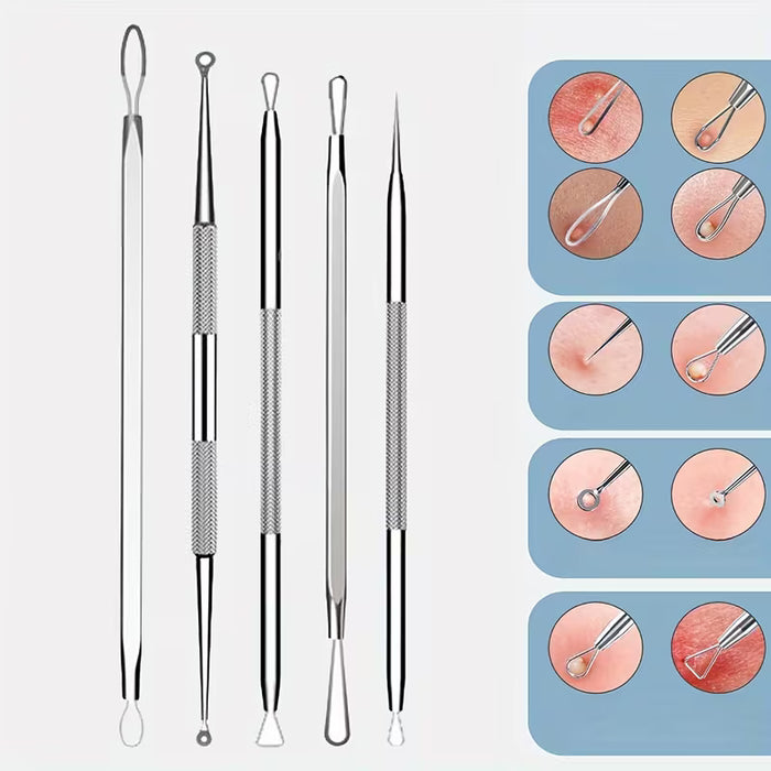 Un set de belleza de 5 piezas hecho de acero inoxidable para eliminar espinillas