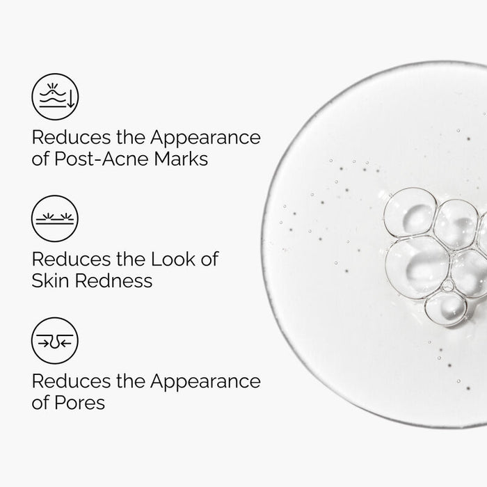 The Ordinary Solución de Aloe 2% + NAG 2%