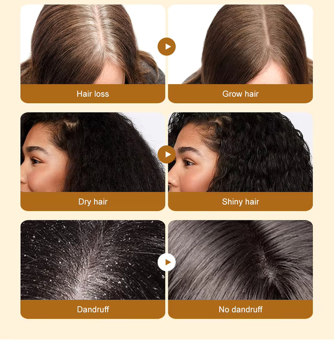 Lewedo Naturals Pack de 3 aceite de Batana crecimiento rápido del cabello para hombres y mujeres y rodillo de microagujas