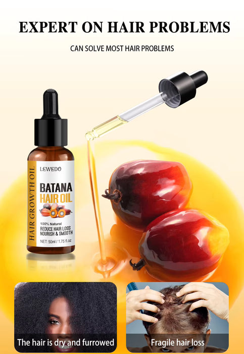 Lewedo Naturals Pack de 3 aceite de Batana crecimiento rápido del cabello para hombres y mujeres y rodillo de microagujas