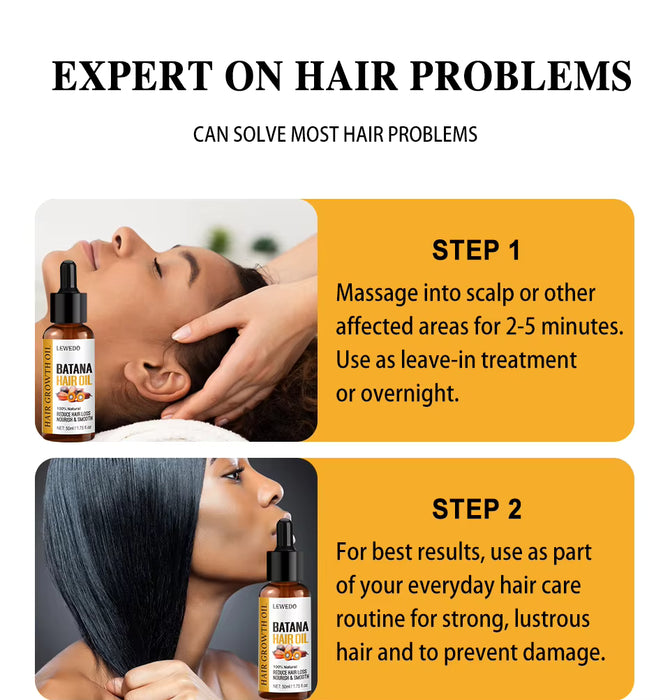 Lewedo Naturals Pack de 3 aceite de Batana crecimiento rápido del cabello para hombres y mujeres y rodillo de microagujas