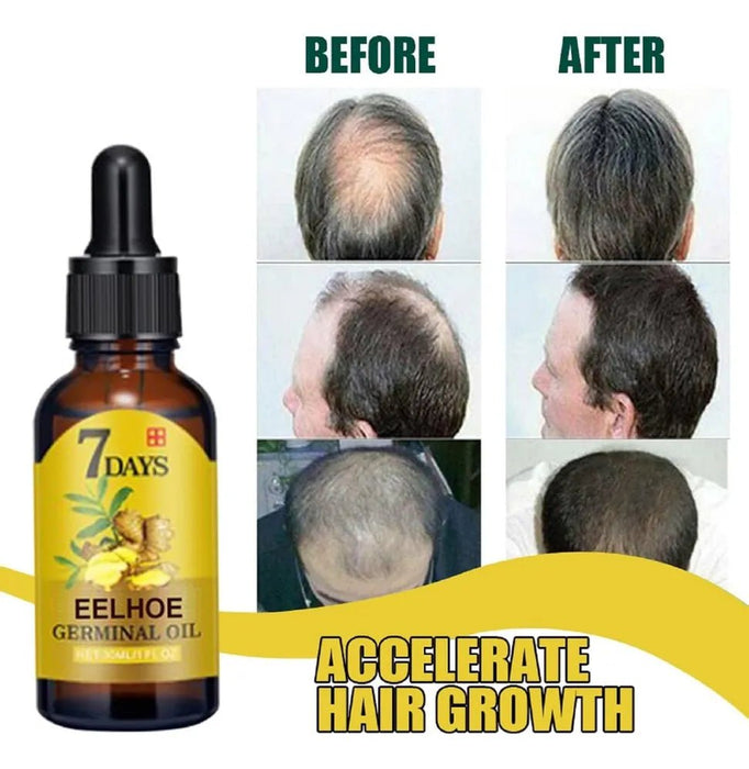 Aceite De Jengibre Para El Crecimiento Del Cabello De 7 Días - Quierox - Tienda Online