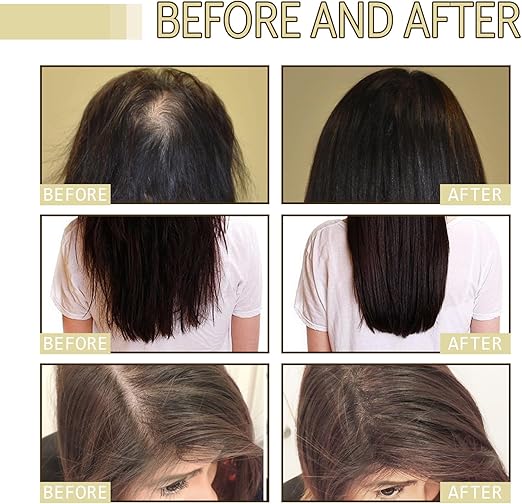 Aceite de romero orgánico para el crecimiento del cabello - Quierox - Tienda Online