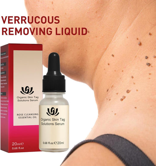 Aceite Esencial removedor de Lunares,Eliminador - Quierox - Tienda Online