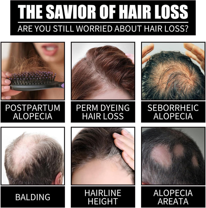 Aceite nutritivo y fortalecedor para el cabello, aceite reparador, 30ml - Quierox - Tienda Online