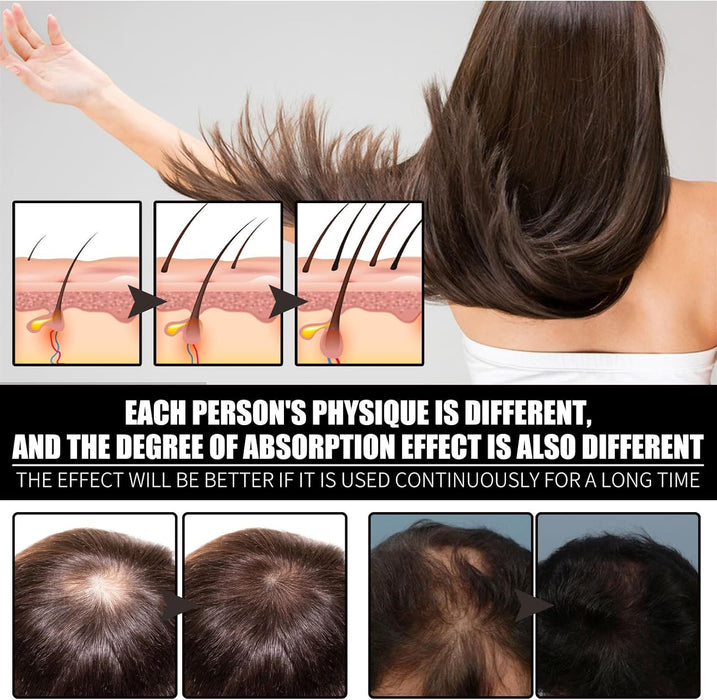 Aceite nutritivo y fortalecedor para el cabello, aceite reparador, 30ml - Quierox - Tienda Online