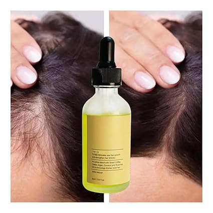 Aceite para el crecimiento del cabello con semillas de romero y perejil - Quierox - Tienda Online