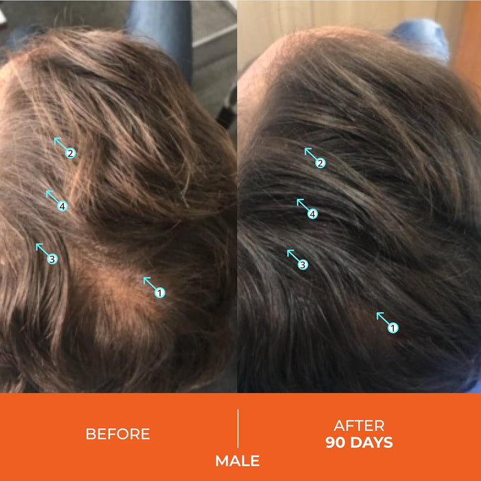 Acondicionador anticaída Revita de DS - Quierox - Tienda Online