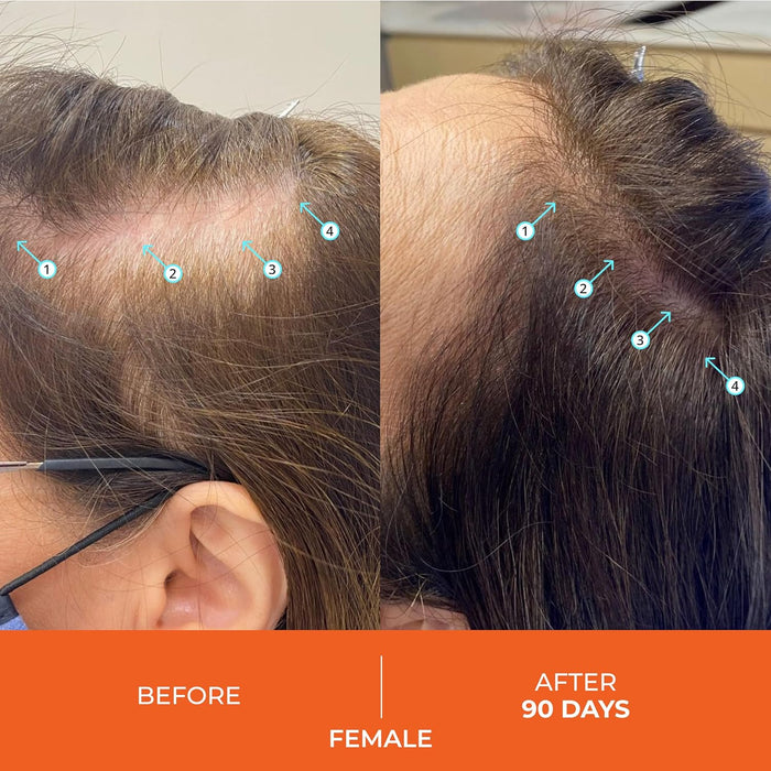 Acondicionador anticaída Revita de DS - Quierox - Tienda Online