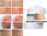 Anyi Beauty Crema para eliminar cicatrices - Quierox - Tienda Online