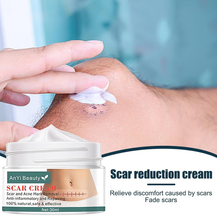 Anyi Beauty Crema para eliminar cicatrices - Quierox - Tienda Online