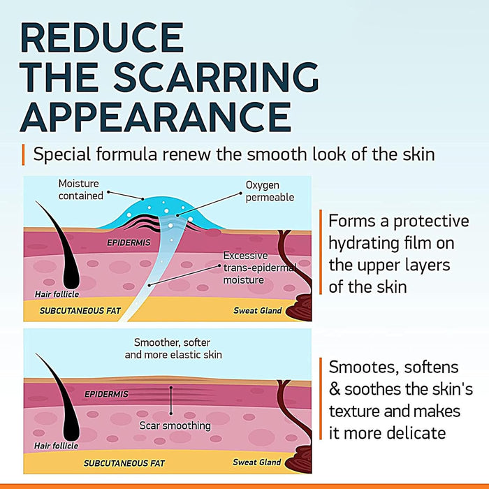 Anyi Beauty Crema para eliminar cicatrices - Quierox - Tienda Online